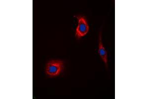 Immunofluorescent analysis of GAK staining in Hela cells. (GAK anticorps  (N-Term))