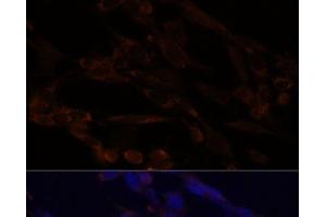Immunofluorescence analysis of NIH/3T3 cells using IKK alpha Polyclonal Antibody at dilution of 1:100. (IKK alpha anticorps)