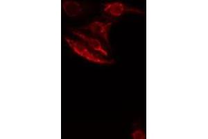 ABIN6276512 staining  HeLa cells by IF/ICC. (SMAD1 anticorps  (Internal Region))