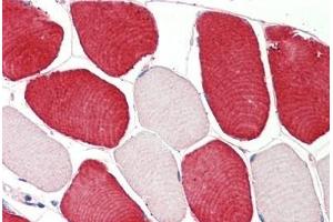 Human Skeletal Muscle: Formalin-Fixed, Paraffin-Embedded (FFPE) (MIA anticorps  (AA 28-40))