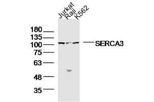 Lane1: jurkat Lane 2: raji Lane 3: K562 lysates probed with SERCA3 Polyclonal Antibody, Unconjugated  at 1:300 dilution and 4˚C overnight incubation. (ATP2A3 anticorps  (AA 101-200))