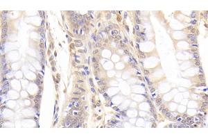 Detection of PADI2 in Human Colon Tissue using Polyclonal Antibody to Peptidyl Arginine Deiminase Type II (PADI2)