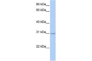 WB Suggested Anti-HOXC11 Antibody Titration:  0. (HOXC11 anticorps  (Middle Region))