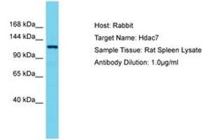 Image no. 1 for anti-Histone Deacetylase 7 (HDAC7) (AA 57-106) antibody (ABIN6750273) (HDAC7 anticorps  (AA 57-106))