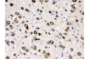IHC testing of FFPE rat brain with TCP1 delta antibody. (CCT4 anticorps)