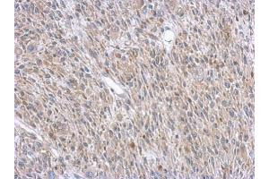 IHC-P Image Immunohistochemical analysis of paraffin-embedded C2C12 xenograft, using ASL, antibody at 1:500 dilution.