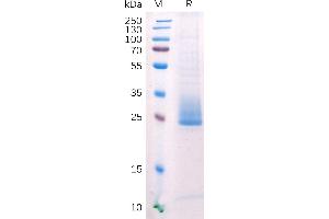 Human ANG Protein, His Tag on SDS-PAGE under reducing condition