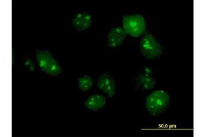 Immunofluorescence of purified MaxPab antibody to TTLL6 on HeLa cell. (TTLL6 anticorps  (AA 1-569))