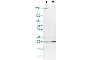 Western Blot analysis of Lane 1: NIH-3T3 cell lysate (mouse embryonic fibroblast cells) and Lane 2: NBT-II cell lysate (Wistar rat bladder tumour cells) with VPS28 polyclonal antibody . (VPS28 anticorps)