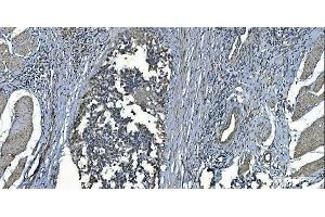 IHC analysis of MCU using anti-MCU antibody (ABIN7601931). (MCU anticorps  (AA 51-351))