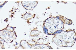 Immunohistochemistry of paraffin-embedded Human placenta using MADCAM1 Polyclonal Antibody at dilution of 1:100 (40x lens). (MADCAM1 anticorps)