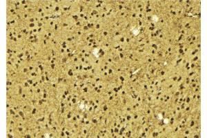 ABIN6275631 at 1/100 staining Mouse brain tissue by IHC-P.