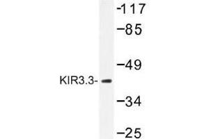 Image no. 1 for anti-Potassium Inwardly-Rectifying Channel, Subfamily J, Member 9 (KCNJ9) antibody (ABIN317838) (KCNJ9 anticorps)