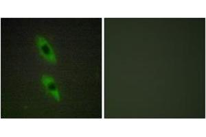 Immunofluorescence analysis of HuvEc cells, using FADD Antibody. (FADD anticorps  (AA 101-150))