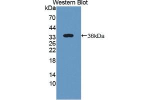 Detection of Recombinant ST2, Human using Polyclonal Antibody to Syntenin 2 (ST2) (SDCBP2 anticorps  (AA 1-292))