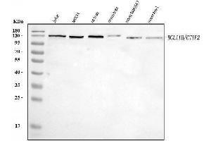 Western blot analysis of Ctip2/BCL11B using anti-Ctip2/BCL11B antibody (ABIN7602551).