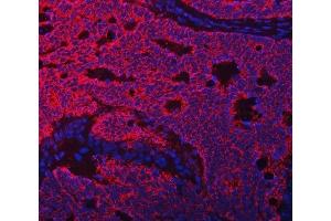 IF analysis of TFEB using anti-TFEB antibody (ABIN7600648).