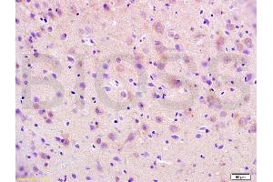 Formalin-fixed and paraffin embedded mouse brain tissue labeled with Anti-RAP1A Polyclonal Antibody, Unconjugated (ABIN687472) at 1:200 followed by conjugation to the secondary antibody, (SP-0023), and DAB staining