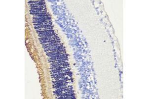 Immunohistochemistry of paraffin-embedded mouse retina using Rhodopsindopsin antibody (ABIN7269975) at dilution of 1:200 (40x lens).