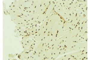 ABIN6276435 at 1/100 staining Mouse brain tissue by IHC-P. (MSH6 anticorps  (Internal Region))