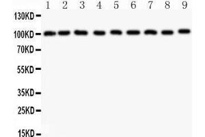 Western Blotting (WB) image for anti-Cas-Br-M (Murine) Ecotropic Retroviral Transforming Sequence (CBL) (AA 556-906) antibody (ABIN3043746) (CBL anticorps  (AA 556-906))