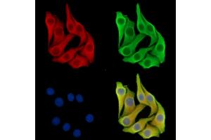 ABIN7097156 and ABIN7101224 staining Hela cells by IF/ICC.