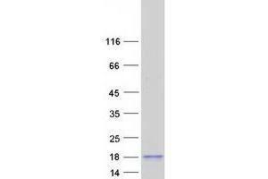Validation with Western Blot