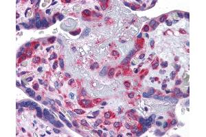 Immunohistochemistry (IHC) image for anti-Y Box Binding Protein 1 (YBX1) (Middle Region) antibody (ABIN2775773) (YBX1 anticorps  (Middle Region))