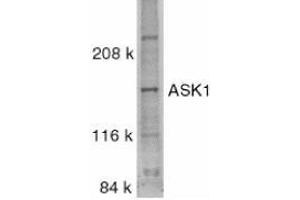 Western blot analysis of ASK1 in SW1353 whole cell lysate with AP30085PU-N ASK1 antibody at 1/500 dilution. (ASK1 anticorps  (C-Term))