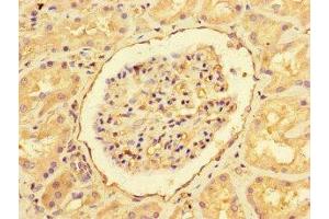 Immunohistochemistry of paraffin-embedded human kidney tissue using ABIN7151461 at dilution of 1:100 (EHD3 anticorps  (AA 269-498))