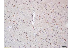 Formalin-fixed and paraffin embedded rat brain labeled with Anti-Myelin Protein Zero Polyclonal Antibody, Unconjugated  at 1:200 followed by conjugation to the secondary antibody and DAB staining