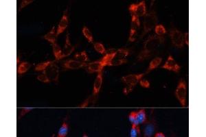 Immunofluorescence analysis of NIH/3T3 cells using CTSL Polyclonal Antibody at dilution of 1:100. (Cathepsin L anticorps)