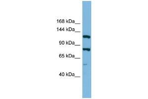 WB Suggested Anti-HYOU1 Antibody Titration: 0. (HYOU1 anticorps  (Middle Region))