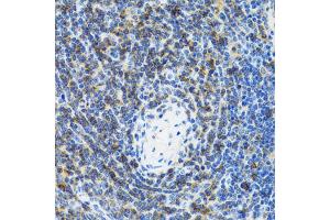 Immunohistochemistry of paraffin-embedded rat spleen using SRP19 antibody (ABIN2560139) at dilution of 1:100 (40x lens). (SRP19 anticorps)