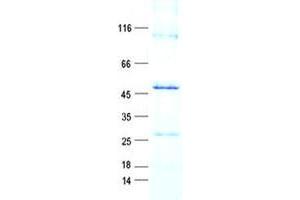 Validation with Western Blot