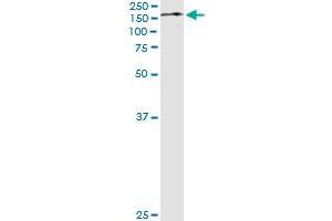 Immunoprecipitation of TRIM24 transfected lysate using anti-TRIM24 monoclonal antibody and Protein A Magnetic Bead , and immunoblotted with TRIM24 MaxPab rabbit polyclonal antibody. (TRIM24 anticorps  (AA 432-569))
