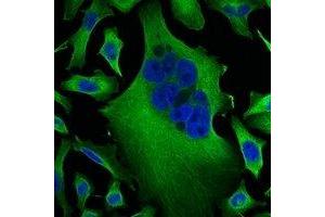 Immunofluorescent analysis of Beta-tubulin staining in Hela cells.