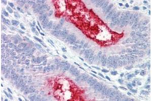 Anti-ENPP3 antibody  ABIN1048561 IHC staining of human uterus.