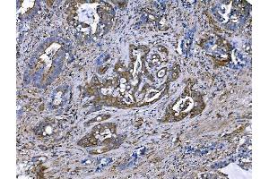 IHC analysis of IQGAP1 using anti-IQGAP1 antibody (ABIN7600509).