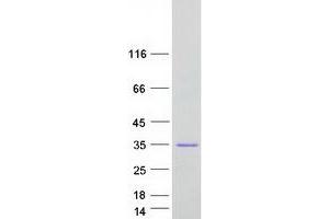 Validation with Western Blot