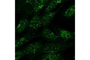 ABIN571095 (5ug/ml) staining of formaldehyde-fixed SH5Y5Y and detected with Alexa 488 in confocal microscopy.
