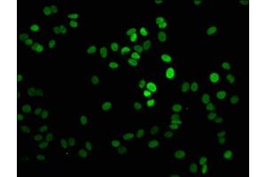 Immunofluorescence staining of HepG2 cells with ABIN7139585 at 1:2. (Histone H1 anticorps  (meLys101))