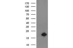 Western Blotting (WB) image for anti-Destrin (Actin Depolymerizing Factor) (DSTN) antibody (ABIN1497907)