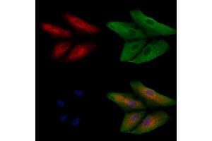 ABIN7094699 and ABIN7098750 staining  cells by IF/ICC.