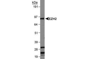 Western blot analysis of EZH2 in Jurkat whole cell lysate using EZH2 polyclonal antibody . (EZH2 anticorps  (AA 300-400))