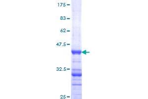DPYD Protein (AA 1-110) (GST tag)