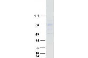 Validation with Western Blot