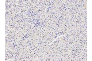 Immunohistochemistry of paraffin-embedded mouse kidney using FAS antibody at dilution of 1:400 (200x lens). (FAS anticorps)