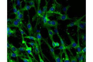 Immunofluorescent staining of C6 cells (right). (Clathrin anticorps  (AA 4-171))