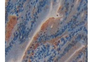 Detection of GSTo1 in Mouse Small intestine Tissue using Polyclonal Antibody to Glutathione S Transferase Omega 1 (GSTo1)